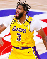 DAVIS ANTHONY (LAL)